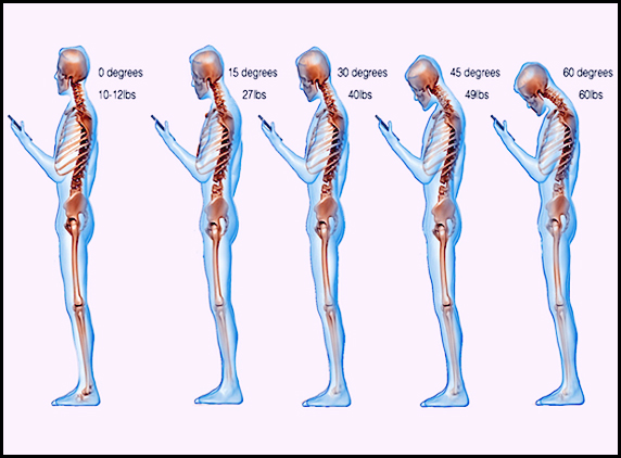 Continuous-Texting-affects-Spine