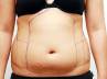 reduce fat, liposuction dangerous, say no to shortcut methods, Exercise regularly
