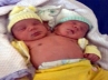 9.9 pound, Maria de Nazare, a brazilian woman give birth to a two headed baby boy, Brazilian