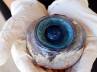 Marine biologists, Florida beach, giant eye ball recovered off florida beach, St petersburg