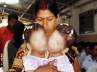 Stuti and Aradhna, Stuti and Aradhna, conjoined twins separated in mp, Conjoined twins