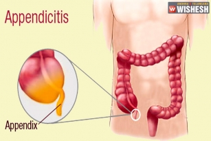 Appendicitis - A Digestive Disorder