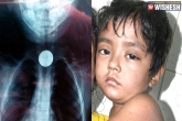 child swallows coin, coin in child's throat, child refused by four hospitals after coin stucks in his throat, Swallow