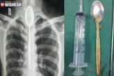 Mr Zhang spoon, Mr Zhang news, chinese man swallows spoon stuck in for a year, Chinese man