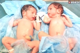 Hyderabad Woman latest, Hyderabad Woman Gandhi hospital, coronavirus positive woman delivers healthy twins in hyderabad, Woman