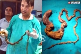 teenager, UP, five foot hairball found in the stomach, Stomach