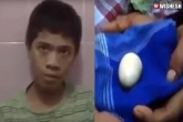 Akmal eggs, Akmal laying eggs, 14 year teenager lays eggs in front of doctors, Indonesia