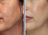Skin care tips, Beauty tips, don t let pigmentation make you hyper, Face creams
