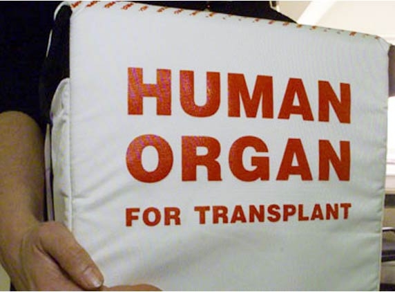 New norms for organ transplant, bad decision